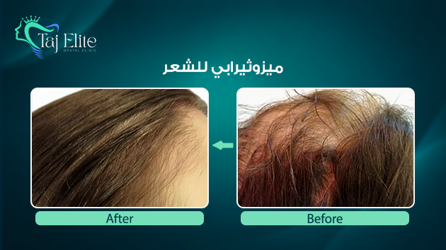 before-^-after11